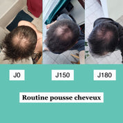 Shampoing solide anti chute de cheveux