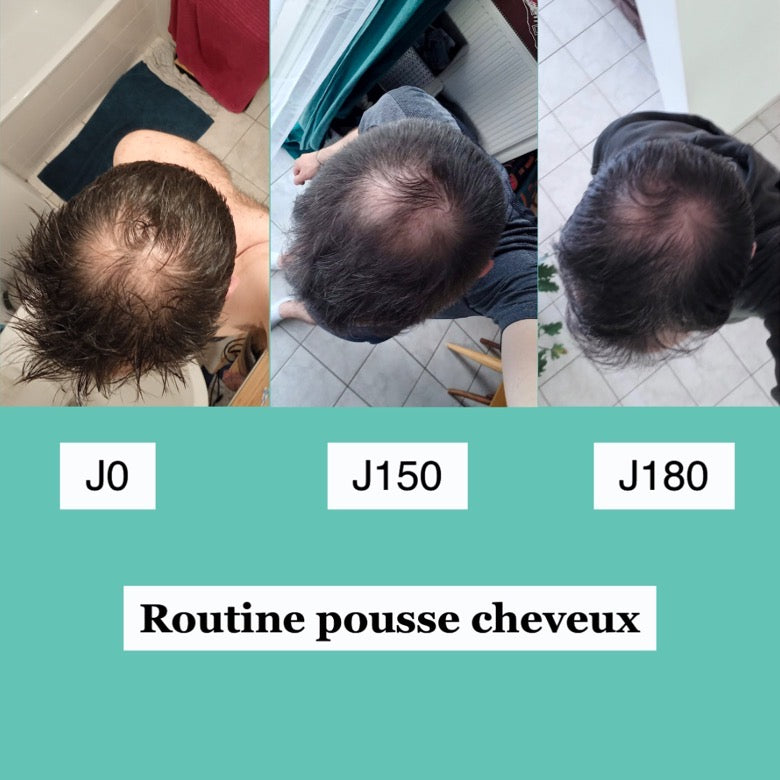 routine_pousse_cheveux.jpg